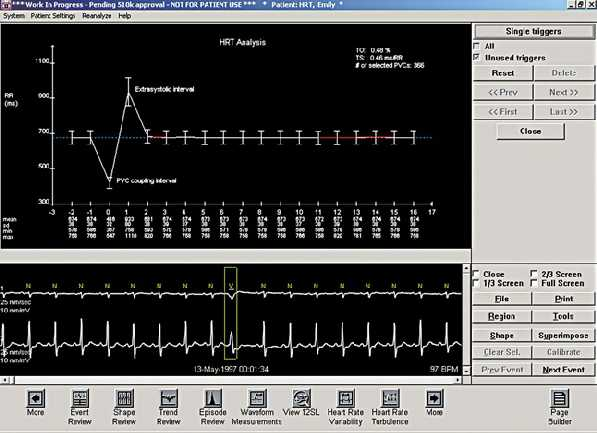 Heart rate