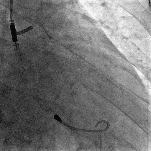 Impella 2.