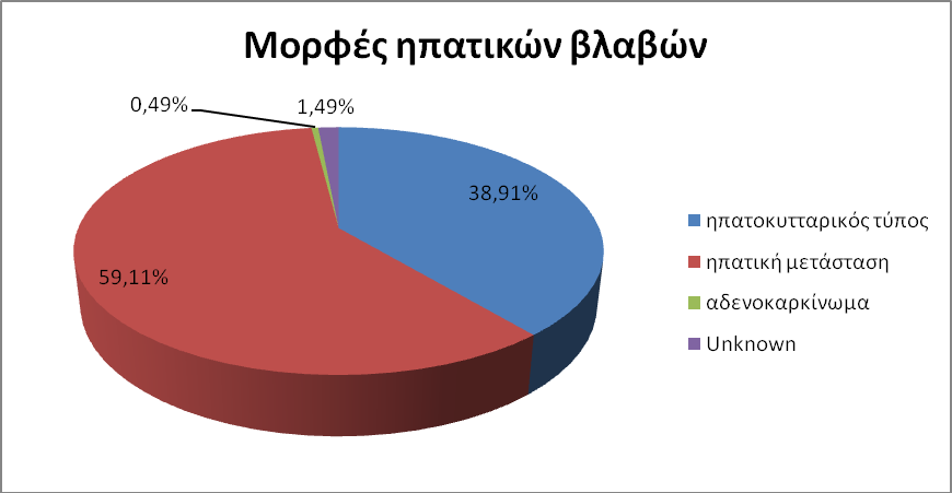 Διάγραμμα 5.2 Παρουσίαση ποσοστό % θήλυ, άρρεν Διάγραμμα 5.3 Παρουσίαση % ηπατική κακοήθεια. 5.2 Ηπατοκυτταρικός καρκίνος του ήπατος Από τις 203 περιπτώσεις (βλάβες) οι 79 (55 ασθενείς) δηλαδή το 39,40% είναι ηπατοκυτταρικος καρκίνος ήπατος.