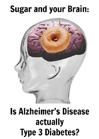Νόσος Alzheimer:Διαβήτης τύπου 3; Βασίλειος