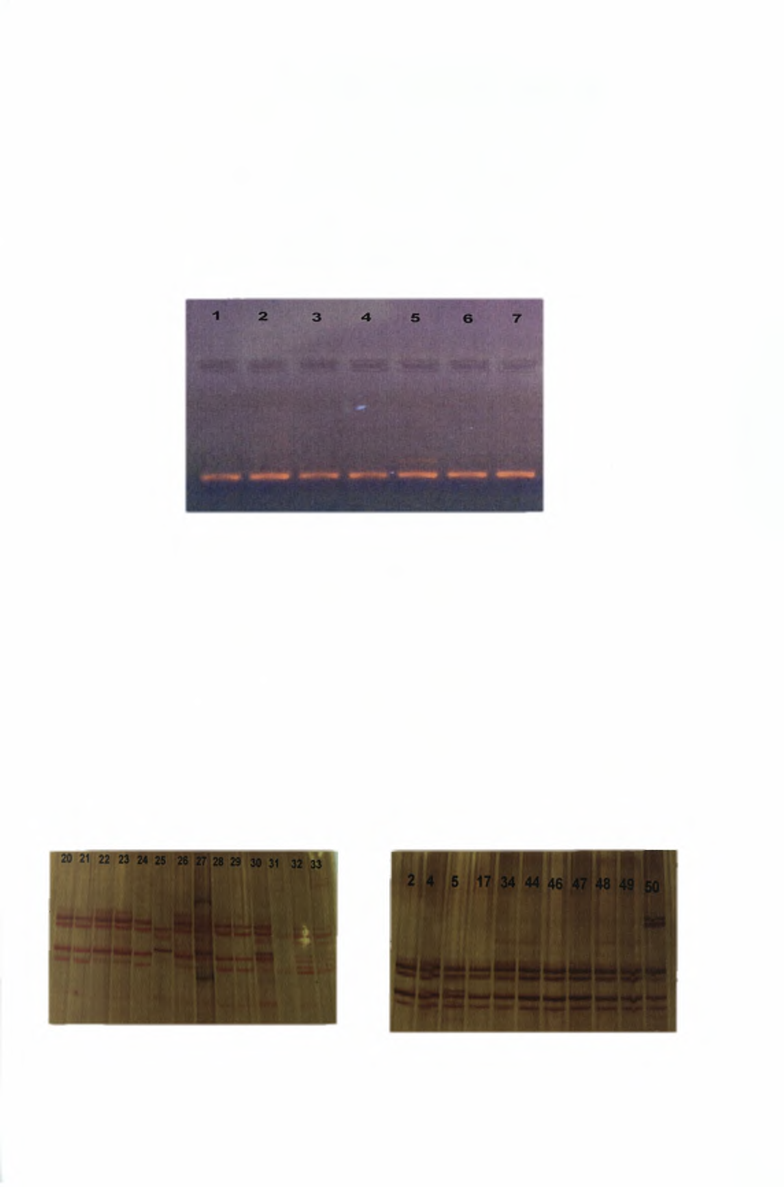 Στην συνέχεια με την τεχνική της PCR πολλαπλασιάσαμε τμήμα του γονιδίου 16s RNA και για τα 50 δείγματα.