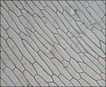 Στο οπτικό μικροσκόπιο Ηδυνατότητα διάκρισης των διαφόρων τμημάτων ενός κυττάρου οφείλεται στο ότι.