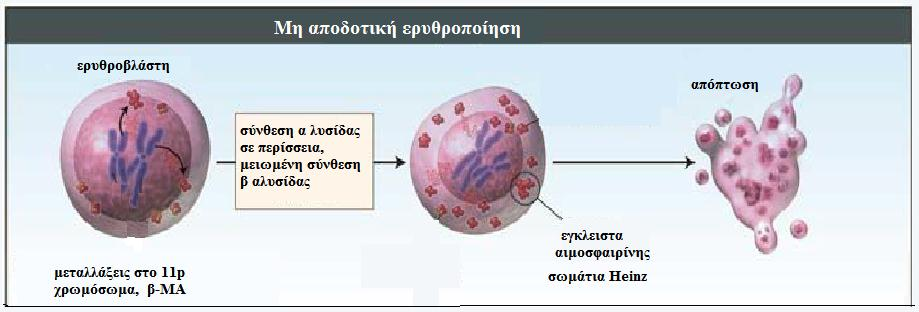 θέση στις διαρθρωτικές αιμοσφαιρινοπάθειες κατέχει η δρεπανοκυτταρική αναιμία που οφείλεται στην παρουσία της αιμοσφαιρίνης S (α2βs2), μία παραλλαγή που επηρεάζει τη θέση 6 της β-αλυσίδας,