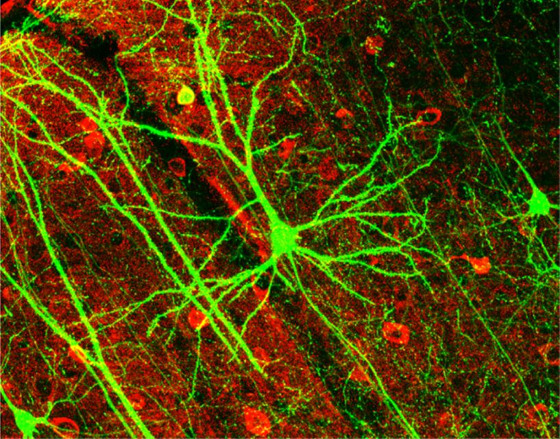 3.Τεχνητά Νευρωνικά Δίκτυα Το Τεχνητό Νευρωνικό Δίκτυο είναι ένα σύστημα βασισμένο στην λειτουργία και την δομή των βιολογικών νευρωνικών δικτύων.
