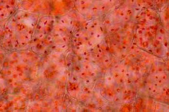 Οι εξωτερικές στρώσεις αποτελούνται από μικρά κύτταρα με πολλούς και μικρούς χρωμοπλάστες. Όσο προχωρούμε προς το εσωτερικό του περικαρπίου τα κύτταρα είναι μεγαλύτερα και οι χρωμοπλάστες αραιότεροι.