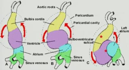 Outflow Tract Ventricular Arrhythmias: