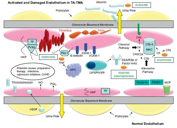 Από Jodele S., Laskin B et al. Blood Rev 2015;29(3):191-204. Η παραπάνω περιγραφή αναδεικνύει πιθανούς θεραπευτικούς στόχους, όπως αναλύεται σε παρακάτω κεφάλαιο.