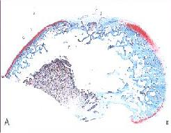 Lipiello et al 2000