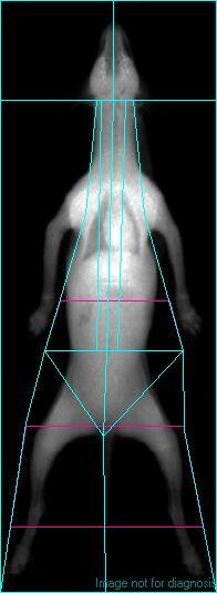 Score DEXA metoda: Dual-Energy X-ray Absorptiometry: najprecizniji