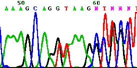ΓΕΝΕΤΙΚΗ ΑΝΑΛΥΣΗ = 2509delA mutation in PKP2b gene Z FAMILY SD (72 (72 Z G Z P K E