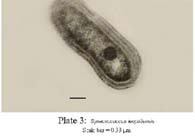 ANABAENA 20.CHLORELLA 10.CYLINDROSPERMUM 21.SCENEDESMUS 11.