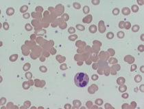 V krvni obtok prispejo le zrele, diferencirane celice. nastajanje krvnih celic se imenuje hematopoeza. Celice obarvamo in si jih ogledamo pod mikroskopom.