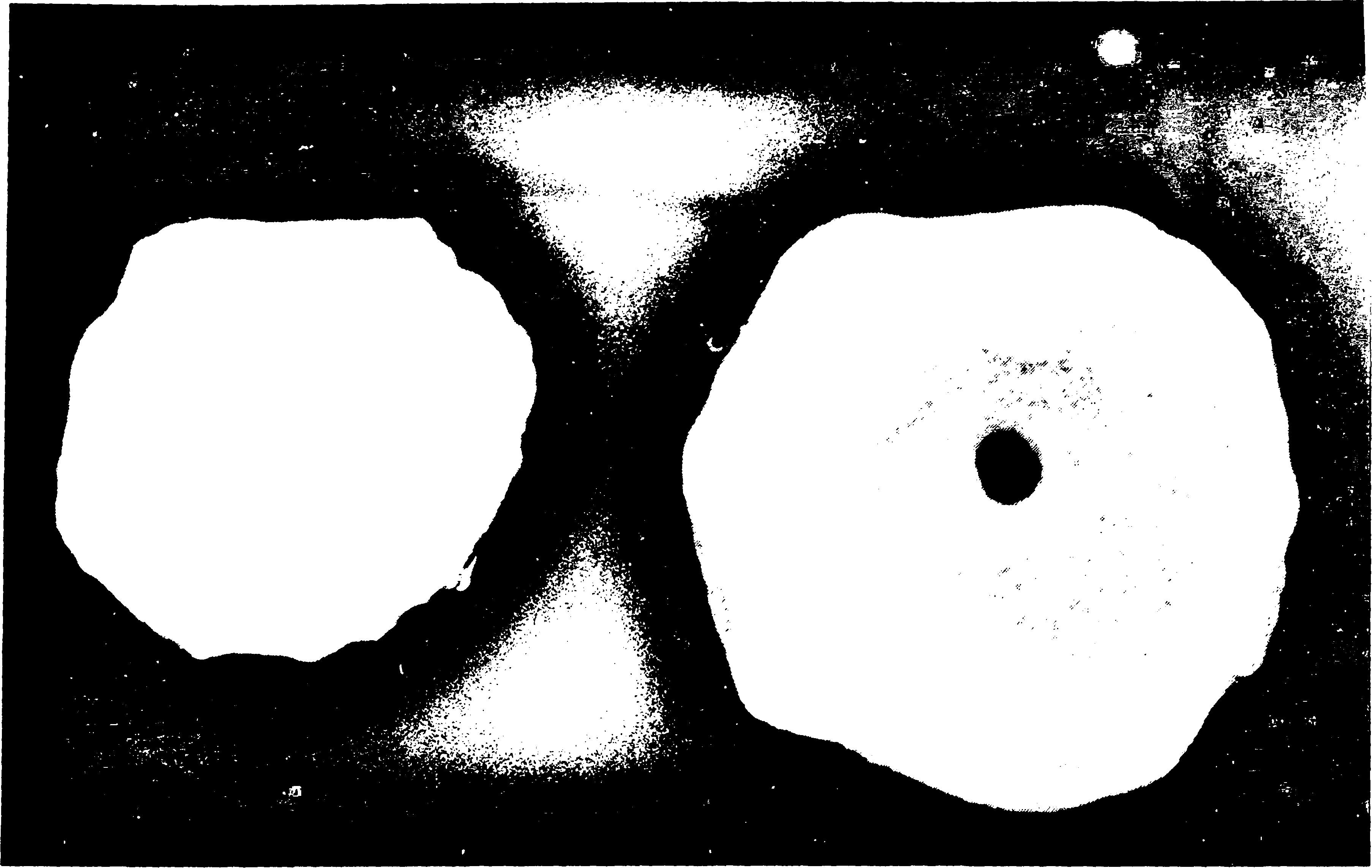 Πιθανά σύμβολα Ι.Β.1 (αριστερά) και Ι.Β.2 (δεξιά).