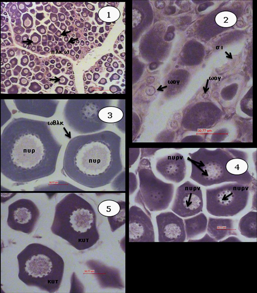 Εικόνα 3.1. Ιστολογικές τομές του Pagrus pagrus στο στάδιο της προλεκιθογένεσης. Εικ.3.1.1: Γενική άποψη της ωοθήκης στο στάδιο της προλεκιθογένεσης. Εικ.2-5: Λεπτομέρειες των προλεκιθογόνων ωοκυττάρων.