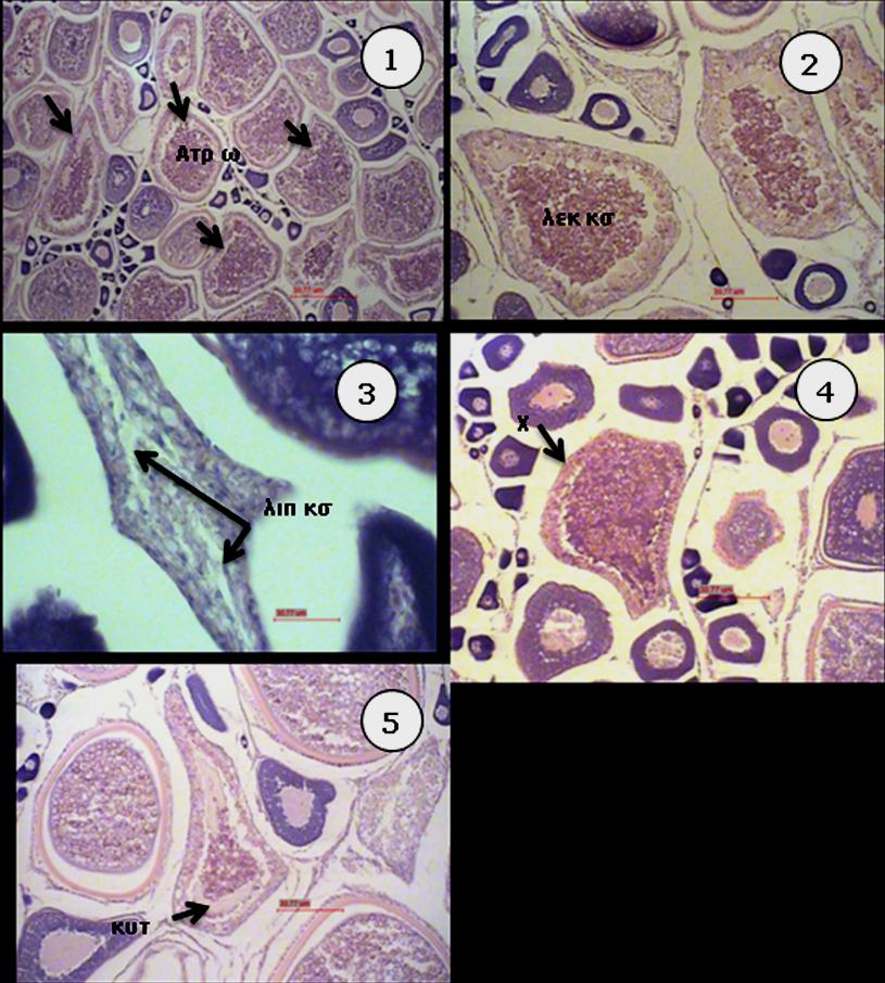 Εικόνα 3.6. Ιστολογικές τομές του Pagrus pagrus σε ατρησία. Εικ.3.6.1: Γενική άποψη ωοθήκης από λεκιθικά ατρητικά ωοκύτταρα. Εικ.3.6.2-5: Λεπτομέρειες ατρητικών ωοκυττάρων.
