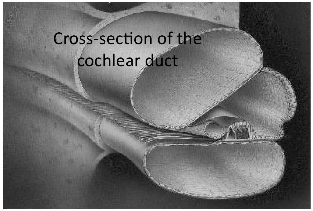 Εικόνα 1.6: Απεικόνιση της διατομής του κοχλιακού αγωγού. Διακρίνονται οι τρεις κοιλότητες, οι μεμβράνες που τις διαχωρίζουν και το όργανο του Corti.