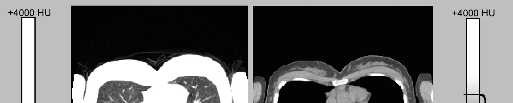 Kontrast v CT obraz odtiene šedej