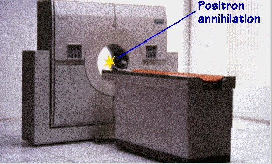 PET Pozitrónová emisná tomografia (PET) o aplikácia zdroja