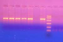 Εικόνα Β-4: Το πρότυπο ζωνών των προϊόντων μιας αντίδρασης PCR.