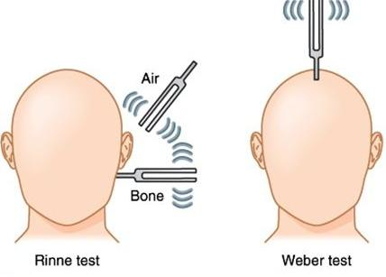 Εξέταση Weber Αποτελεί έναν τύπο εξέτασης που εμπεριέχεται στην κατηγορία έλεγχου ακοής με τη χρήση τονοδοτών.