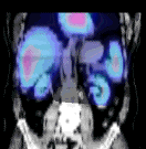 PET/SPECT εφαρμογές μοριακής απεικόνισης κάθε είδους μεταβολική και κυτταρική δραστηριότητα
