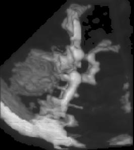 f εκπομπής θ f λήψης υ ροής heart of an embryo (27 week of gestation) www.