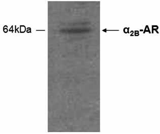 Western blot ανάλυση Έκφραση των α2b ARs στα αιμοπετάλια Μελετήθηκαν τα επίπεδα πρωτεινικής έκφρασης με την