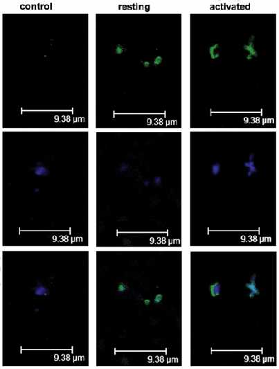 Έκφραση των α2b ARs στα αιμοπετάλια Εικόνες από ομοεστιακό μικροσκόπιο: χρώση διπλού ανοσοφθορισμού - πρωτογενές αντίσωμα : a2b-ar Ab - δευτερογενές αντίσωμα: Alexa Fluor 488 Οι a2b-ar