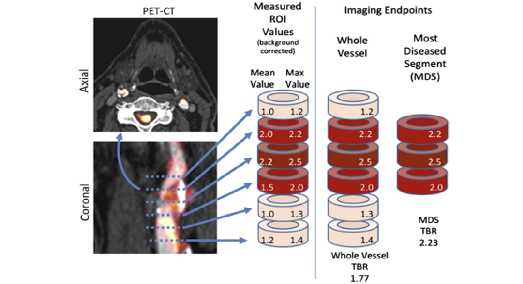 Μετρήσεις με PET/CT Ο ασθενής παραμένει νήστις από το προηγούμενο βράδυ και σε δίαιτα χαμηλή σε υδατάνθρακες για 24 ώρες.