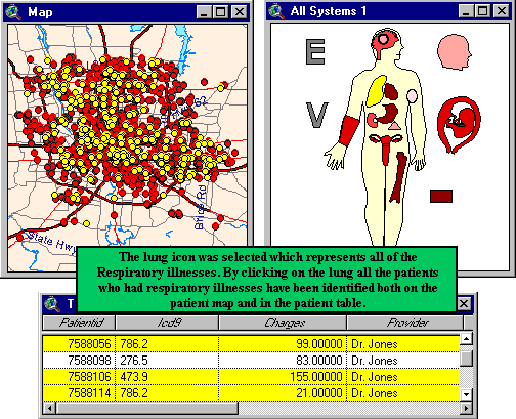 Εφαρμογή με GIS Κάνοντας κλικ στο πνεύμονα όλοι οι ασθενείς που είχαν