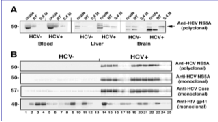 Το HCV RNA στο CSF είναι όμοιο με τα PBMC Σε 8 από 13 δείγματα CSF από HCV+ άτομα, εντοπίστηκε HCV RNA Η αλληλουχία περιλαμβάνει όλη την 5 μημεταφραζόμενη περιοχή του ιικού φορτίου απομονωμένη από