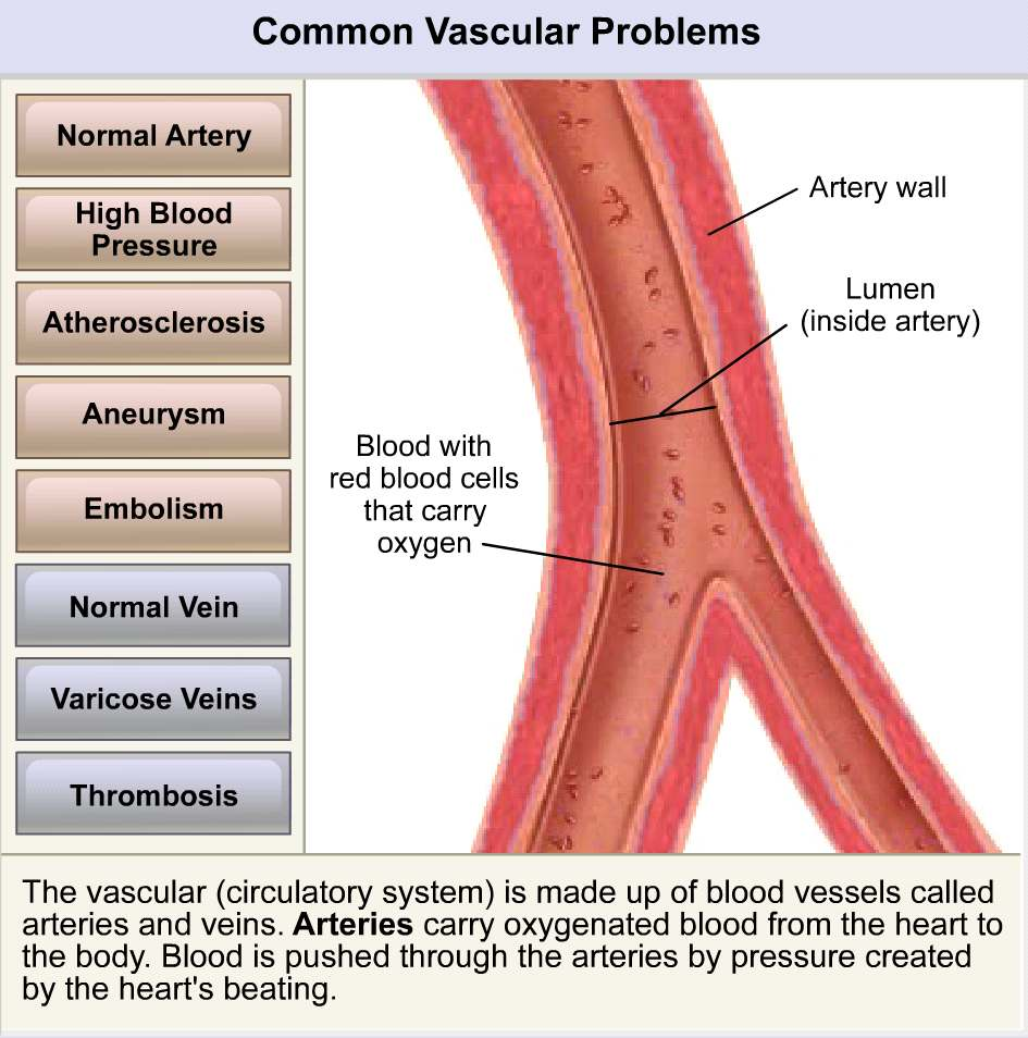 Patologie vasculara