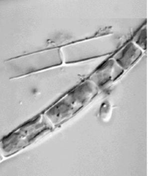 Μονοκύτταρα Πολυκύτταρα νηματοειδή Κοινόκυτο Γένος Vaucheria Εικ. 13.