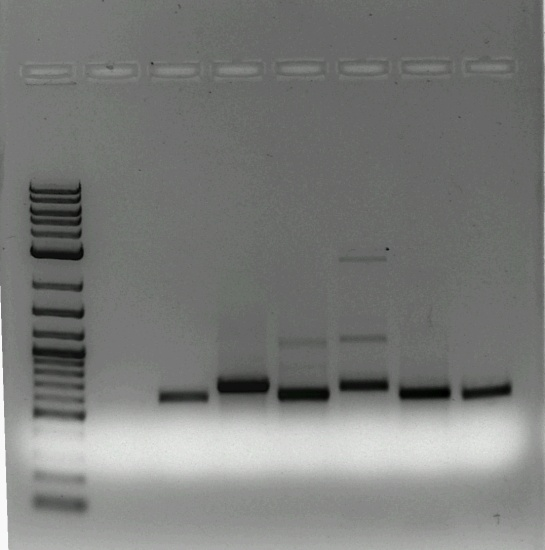 66 Σχήμα 4.2. Ανάλυση σε πήκτη αγαρόζης των προϊόντων PCR για τα έξι γονίδια.