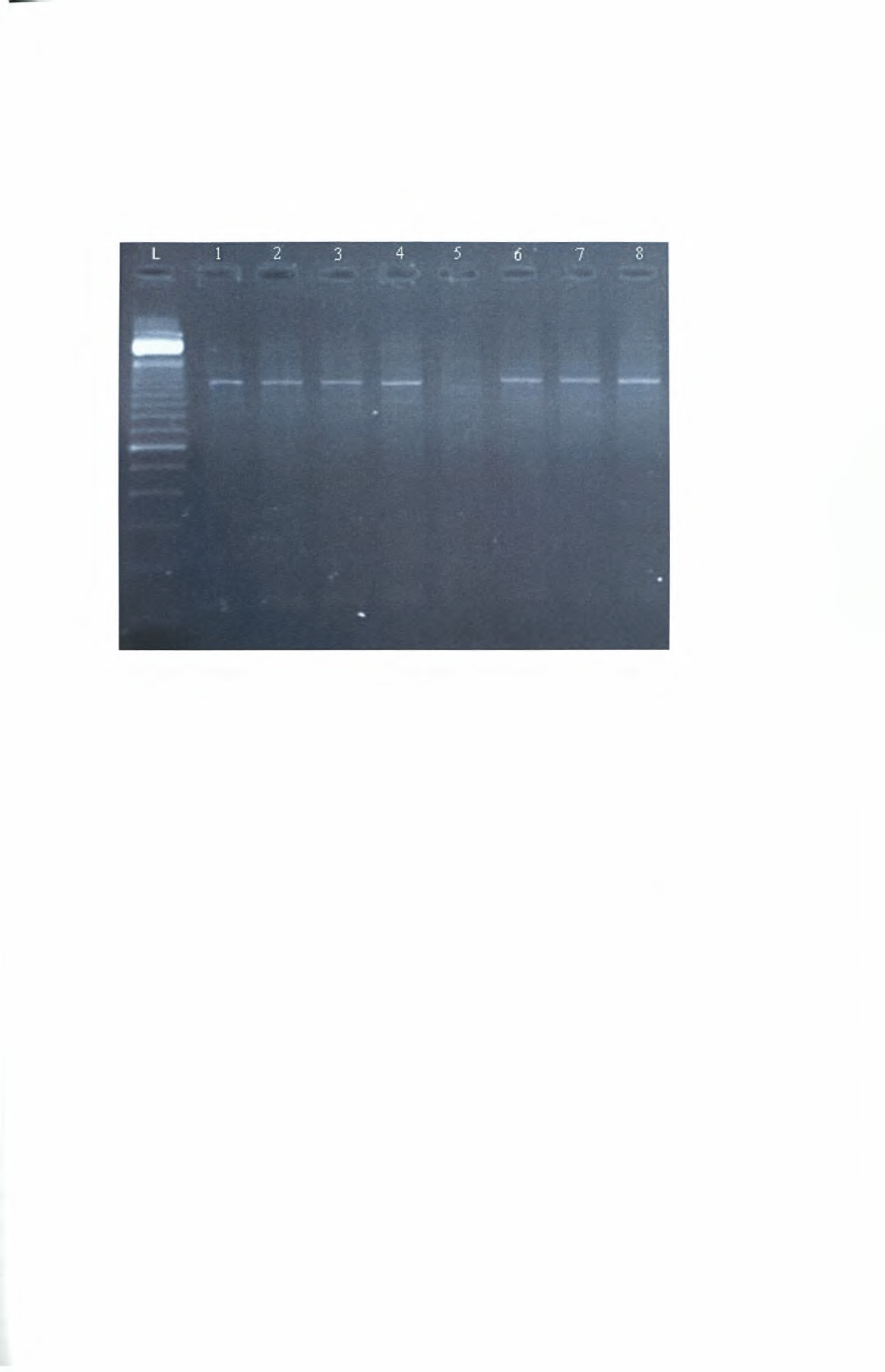 DNA και απουσία αναστολέων της PCR απαραίτητο βήμα για την διεξαγωγή των περαιτέρω πειραμάτων. Εικόνα 9.1: Αποτελέσματα της PCR για την ενίσχυση του γονιδίου της β-γλοβουλίνης.