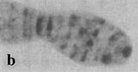 Εικόνα 24: Χαρακτηριστική άκρη (tip) που αντιστοιχεί στον βραχίονα 1R (a,b) του είδους Bactrocera olea και άκρη που αντιστοιχεί στην αρχή του βραχίονα ΙΙR (c) (Mavragani- Tsipidou et al., 2002) 1.5.2.3 Ζωνικό πρότυπο Κατά τον επιμήκη άξονα κάθε χρωματίδας, η ποικιλία στο βαθμό της συσπείρωσης του DNA και οι αντίστοιχες πρωτεΐνες οδηγούν σε ποικιλομορφία στη συγκέντρωση της χρωματίνης.