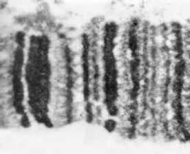 Εικόνα 25: Τμήμα του πολυταινικού βραχίονα ΙΙR του είδους Drosophila melanogaster από ηλεκτρονικό μικροσκόπιο, όπου διακρίνονται οι σκουρόχρωμες και οι ανοιχτόχρωμες ζωνώσεις (Zhimulev and Koryakov,