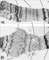 Εικόνα 27: Εικόνα από ηλεκτρονικό μικροσκόπιο όπου παρατηρείται η δημιουργία puff στη θέση του γονιδίου της εκδυσόνης στο είδος Drosophila melanogaster.