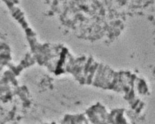Εικόνα 50: Η θέση του γονιδίου sxl στον βραχίονα 5R του είδους Bactrocera kandiensis.