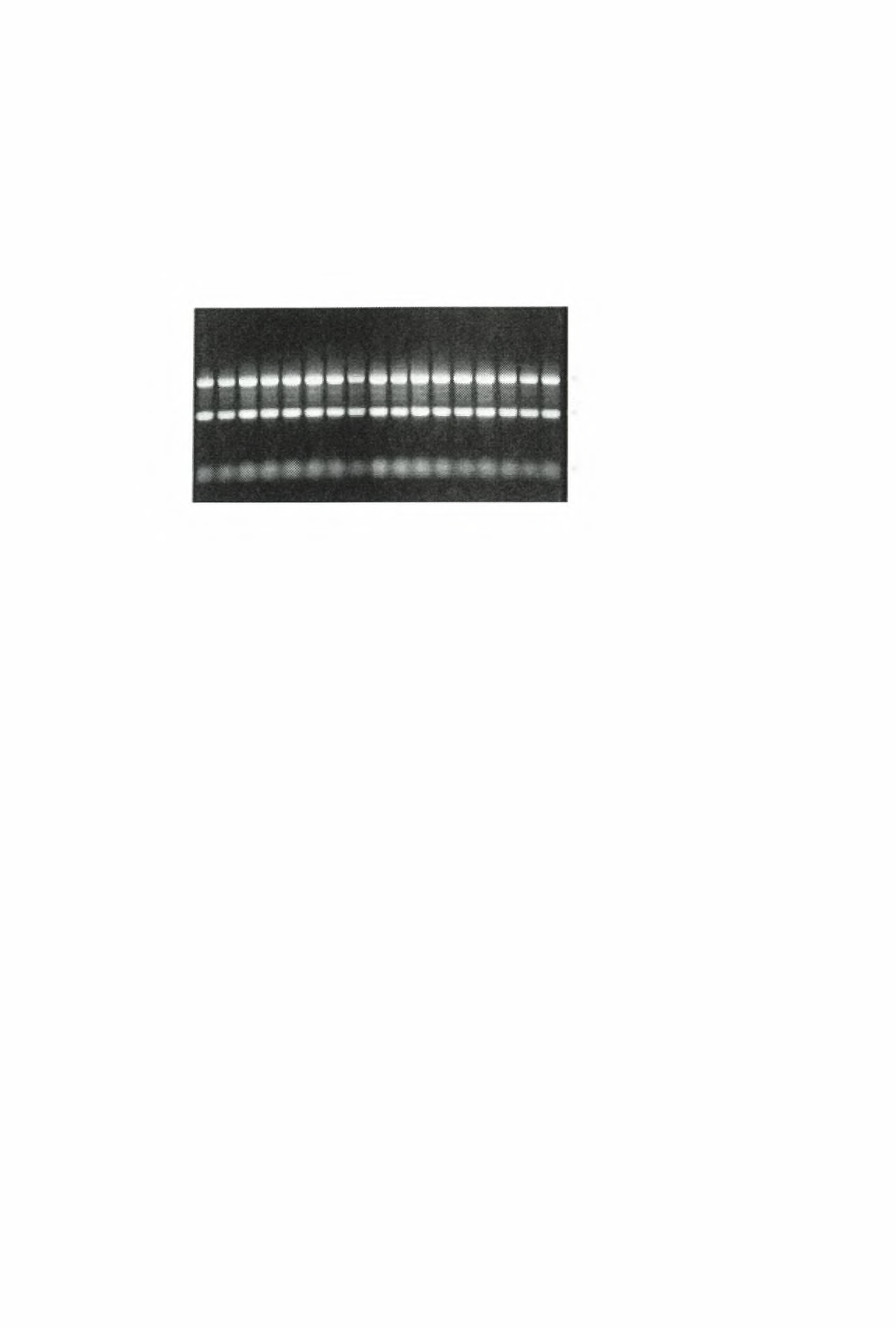 συγκέντρωση RNA = αραίωση χ OD26o x 40 (mgr/ml) VII. Ηλεκτροφόρηση-Έλεγχος ποιότητας Για να ελεγχθεί η ποιότητα του RNA πραγματοποιήθηκε σε κάθε δείγμα ηλεκτροφόρηση σε πηκτή αγαρόζης 2% (εικόνα 11).