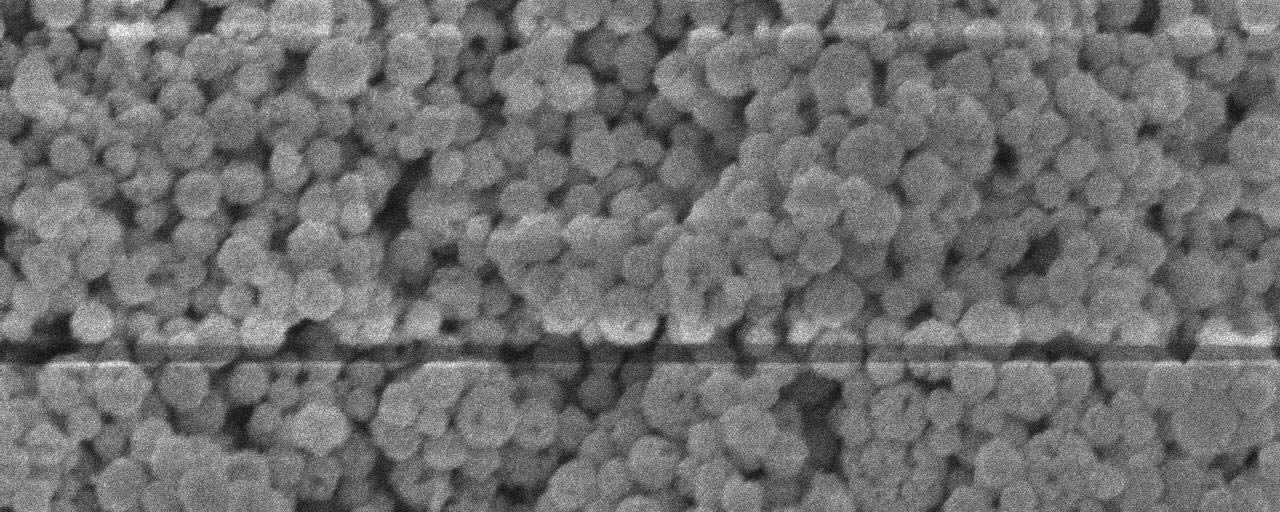 Fig. 3 TEM picture showing