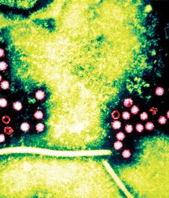 Ο ιόσ ανικει ςτο γζνοσ Hepevirus, είναι μικρόσ ςφαιρικόσ, μθ ελυτροφόροσ, περιβάλλεται από καψίδιο, παρουςιάηει εικοςαεδρικι ςυμμετρία και αποτελείται από διμερι μιασ πρωτεΐνθσ 660 αμινοξζων Σα ιικά