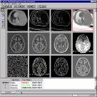 τηλεϊατρική στην κλινική πρόσληψη εικόνων από απεικονιστική συσκευή παρουσίαση εικόνων επεξεργασία εικόνων PACS πληροφοριακό σύστημα αποθήκευσης και οργάνωσης