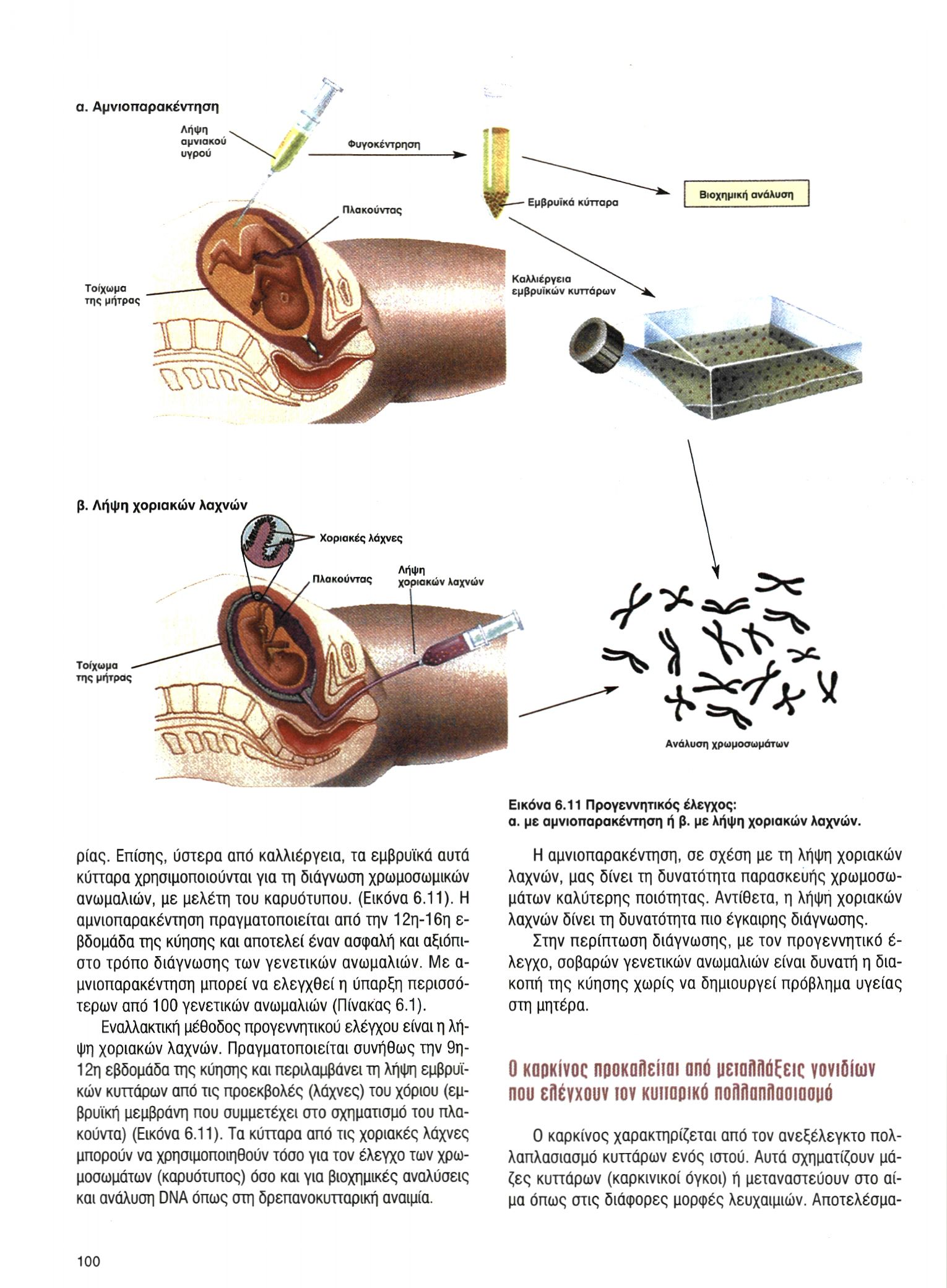 Εικόνα 6.11 Προγεννητικός έλεγχος: α. με αμνιοπαρακέντηση ή β. με λήψη χοριακών λαχνών. ρίας.