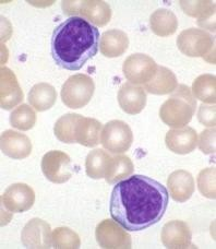 Τ-Λεμφοκύτταρα ~80-85% των λεμφοκυττάρων του αίματος Παραγωγή στο θύμο αδένα Δείκτες - Αντιγόνα επιφανείας: HLA-A,B,C, και τα CD3, CD4, CD8, ΤCR (αβ, γδ) Επιφορτισμένα με: Την άμυνα