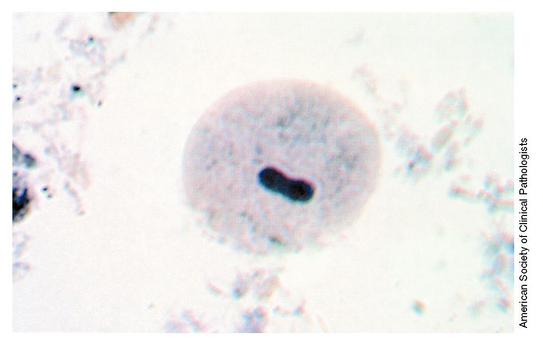 BALONTIDIUM COLI ΒΛΕΦΑΡΙΔΟΦΟΡΟ ΠΡΩΤΟΖΩΟ Εικόνα 14.