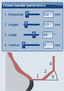 ΧΡΉΣΗ Παράμετροι άκρων στο λογισμικό CAD Στο Ceramill Zolid Preshades πρέπει να προσέχετε να έχουν επαρκές πάχος τα πάχη των άκρων. Προτεινόμενες τιμές: _1. Πάχος άκρου (Horizontal): 0,2 mm _2.