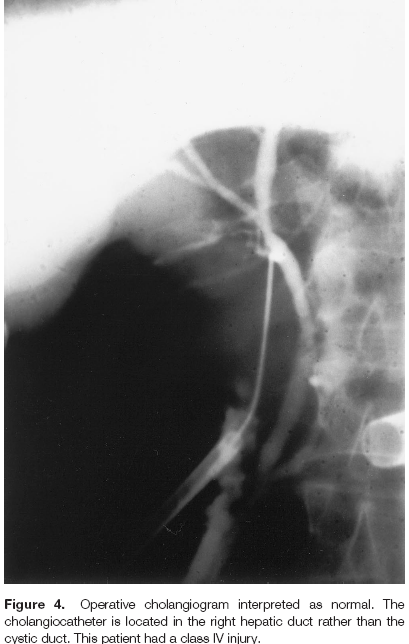 Risk Factors IOC 15 Risk Factors Patient related Acute and chronic cholecystitis Empyema