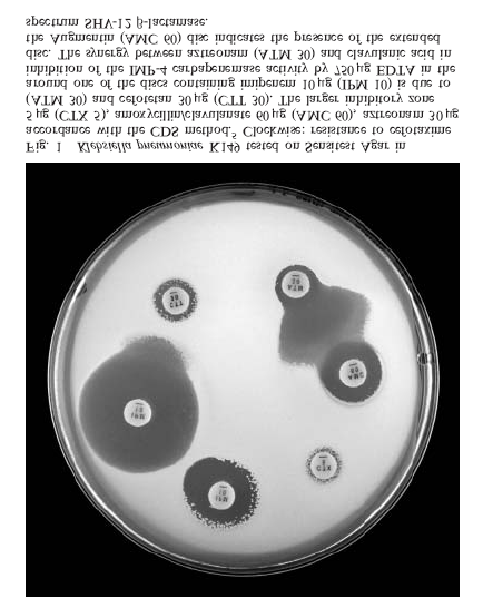 Σε μία μελέτη οι συνδυασμοί ιμιπενέμης EDTA ήταν οι πιο ευαίσθητοι για την ανίχνευση μεταλλο-β-λακταμάσης σε στελέχη Pseudomonas aeruginosa και Acinetobacter baumannii.