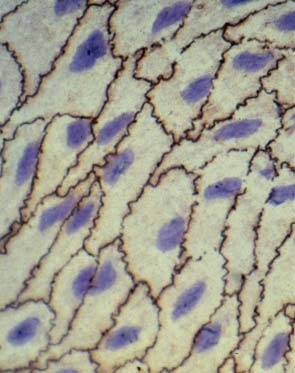 ΕΙΣΑΓΩΓΗ Τα ενδοθηλιακά κύτταρα Τα ενδοθηλιακά κύτταρα (Εικόνα 1) προέρχονται από τα πρόδρομα ενδοθηλιακά κύτταρα, τα οποία παράγονται στο μυελό των οστών και βρίσκονται στην κυκλοφορία του αίματος